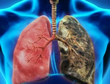 Κάπνισμα: Πότε θα καθαρίσουν οι πνεύμονες αν κόψετε σήμερα το τσιγάρο